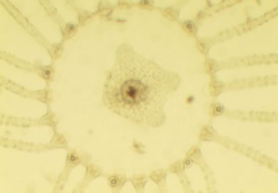 jeune méduse Obelia.sp x 150